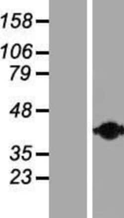 Novus Biologicals™ Calponin 2 Overexpression Lysate