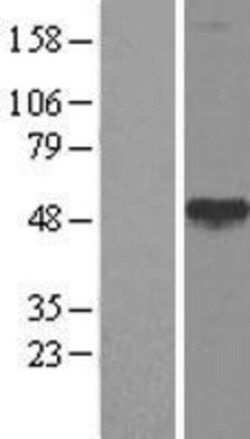 Novus Biologicals&trade;&nbsp;Calreticulin-2/CALR3 Overexpression Lysate