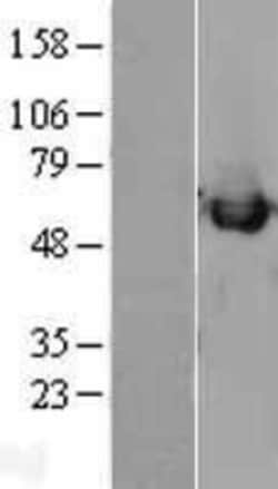 Novus Biologicals&trade;&nbsp;Calreticulin Overexpression Lysate