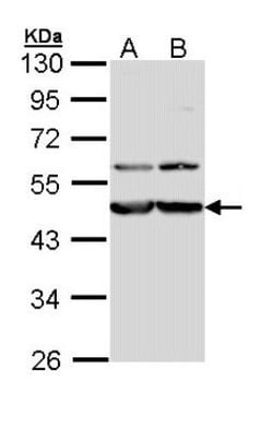 Calreticulin-2/CALR3 Antibody, Novus Biologicals 100 &mu;L | Buy Online | Novus Biologicals | Fisher Scientific
