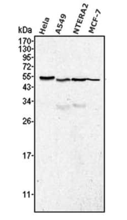 Calreticulin Antibody (1G6A7) - BSA Free, Novus Biologicals:Antibodies:Primary