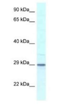 Calsenilin Antibody, Novus Biologicals 100&mu;L; Unlabeled:Antibodies,