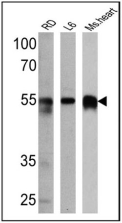 anti-Calsequestrin 1, Polyclonal, Novus Biologicals 0.1mL; Unlabeled:Antibodies,