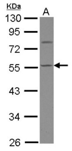 Calsequestrin 1 Antibody, Novus Biologicals 0.1 mL | Buy Online | Novus Biologicals | Fisher Scientific
