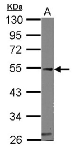 Calsequestrin 1 Antibody, Novus Biologicals 0.1 mL | Buy Online | Novus Biologicals | Fisher Scientific