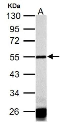 Calsequestrin 1 Antibody, Novus Biologicals 0.1 mL | Buy Online | Novus Biologicals | Fisher Scientific