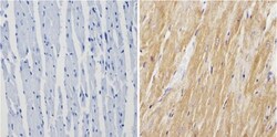anti-Calsequestrin 1, Polyclonal, Novus Biologicals 0.1mL; Unlabeled:Antibodies,