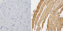 anti-Calsequestrin 1, Polyclonal, Novus Biologicals 0.1mL; Unlabeled:Antibodies,