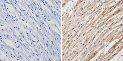 anti-Calsequestrin 1, Polyclonal, Novus Biologicals 0.1mL; Unlabeled:Antibodies,