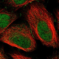 Calsequestrin 2 Antibody, Novus Biologicals:Antibodies:Primary Antibodies