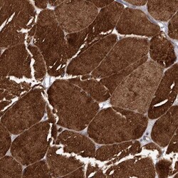 Calsequestrin 2 Antibody, Novus Biologicals:Antibodies:Primary Antibodies