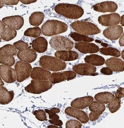Calsequestrin 2 Antibody, Novus Biologicals:Antibodies:Primary Antibodies