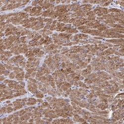 Calsequestrin 2 Antibody, Novus Biologicals:Antikörper:Primärantikörper