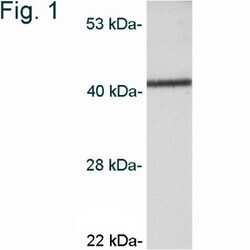 CaM Kinase I Antibody, Novus Biologicals 0.025 mg, Unconjugated:Antibodies,