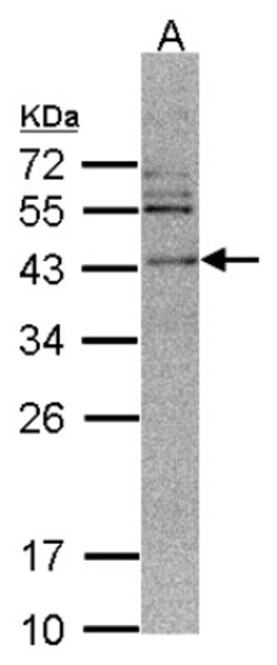 CAMKID Antibody, Novus Biologicals 0.1 mL | Buy Online | Novus Biologicals | Fisher Scientific