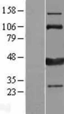 Novus Biologicals&trade;&nbsp;CAMKID Overexpression Lysate