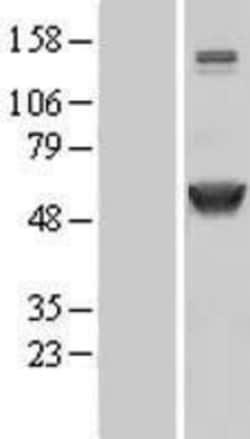Novus Biologicals™ CaM Kinase II alpha Overexpression Lysate