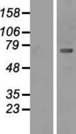 Novus Biologicals&trade;&nbsp;CaMKII beta Overexpression Lysate
