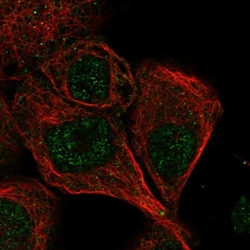 CaM Kinase II delta Antibody, Novus Biologicals 25 &mu;L; Unlabeled:Antibodies,