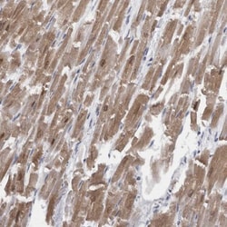 CaM Kinase II delta Antibody, Novus Biologicals 25 &mu;L; Unlabeled:Antibodies,