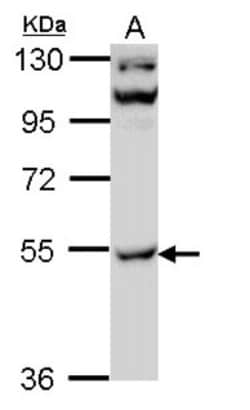 CaM Kinase II gamma Antibody, Novus Biologicals 0.1mL; Unlabeled:Antibodies,
