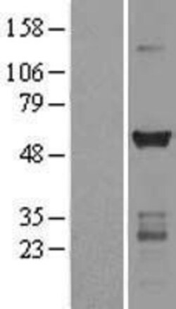 Novus Biologicals&trade;&nbsp;CaM Kinase II gamma Overexpression Lysate