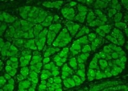 CaMKII alpha/beta, p Thr286, p Thr287 Antibody (22B1), Novus Biologicals