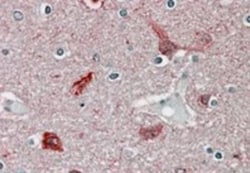 CaM Kinase II alpha Antibody, Novus Biologicals 0.1mg; Unlabeled:Antibodies,