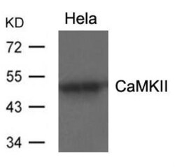 CaM Kinase II alpha Antibody, Novus Biologicals:Antibodies:Primary Antibodies
