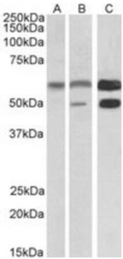 CaM Kinase II alpha Antibody, Novus Biologicals 0.1mg; Unlabeled:Antibodies,