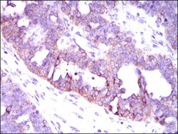 CaMKIV Antibody (8C5B8) - BSA Free, Novus Biologicals 0.1mL; Unlabeled:Antibodies,