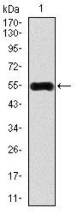 CaMKIV Antibody (8C5B8) - BSA Free, Novus Biologicals 0.1mL; Unlabeled:Antibodies,