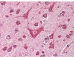 CaMKIV Antibody, Novus Biologicals 0.1mL; Unlabeled:Antibodies, Polyclonal