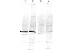 CaMKIV Antibody, Novus Biologicals 0.1mL; Unlabeled:Antibodies, Polyclonal
