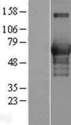 Novus Biologicals&trade;&nbsp;CaMKK alpha Overexpression Lysate