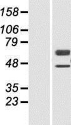 Novus Biologicals&trade;&nbsp;CaMKK2 Overexpression Lysate