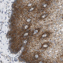 Integrin alpha 6/CD49f Antibody, Novus Biologicals:Antibodies:Primary Antibodies