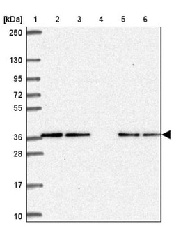 CAMLG Antibody, Novus Biologicals 25 &mu;L, Unlabeled:Antibodies, Polyclonal