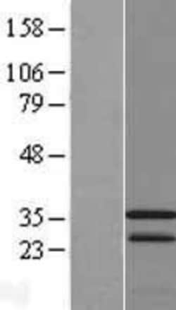 Novus Biologicals&trade;&nbsp;CAMLG Overexpression Lysate
