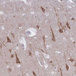 CAMLG Antibody, Novus Biologicals 25 &mu;L, Unlabeled:Antibodies, Polyclonal