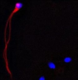 CAMP/Cathelicidin Antibody (OSX12), Novus Biologicals 0.025mg; Unlabeled:Antibodies,
