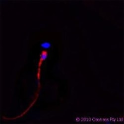 CAMP/Cathelicidin Antibody (OSX12), Novus Biologicals 0.025mg; Unlabeled:Antibodies,