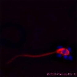 CAMP/Cathelicidin Antibody (OSX12), Novus Biologicals 0.025mg; Unlabeled:Antibodies,