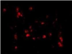 CAMP/LL37/FALL39/Cathelicidin Antibody - BSA Free, Novus Biologicals 0.1mg;