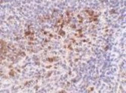 CAMP/LL37/FALL39/Cathelicidin Antibody - BSA Free, Novus Biologicals 0.1mg;