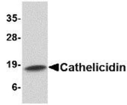CAMP/LL37/FALL39/Cathelicidin Antibody - BSA Free, Novus Biologicals 0.1mg;