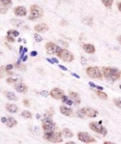 Novus Biologicals Cancer Cell Development Antibody Pack 2 vials:Antibodies