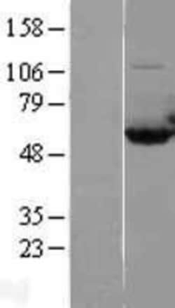 Novus Biologicals&trade;&nbsp;CAP1 Overexpression Lysate