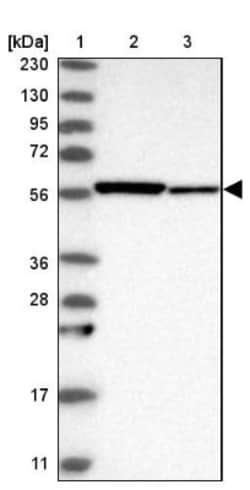 CAP1 Antibody, Novus Biologicals 0.1mL; Unlabeled:Antibodies, Polyclonal
