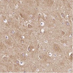 CAP2 Antibody, Novus Biologicals:Antibodies:Primary Antibodies